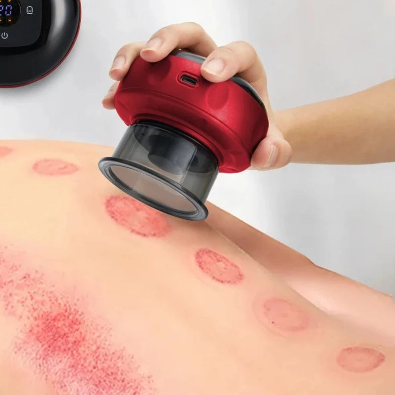 ELECTRIC VACUUM CUPPING MASSAGE